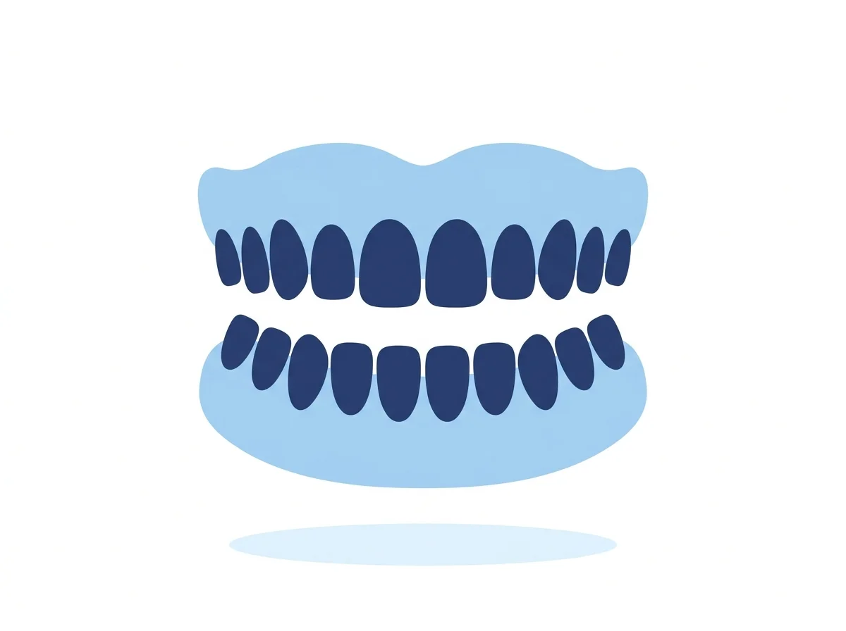 Ilustração de uma dentadura completa