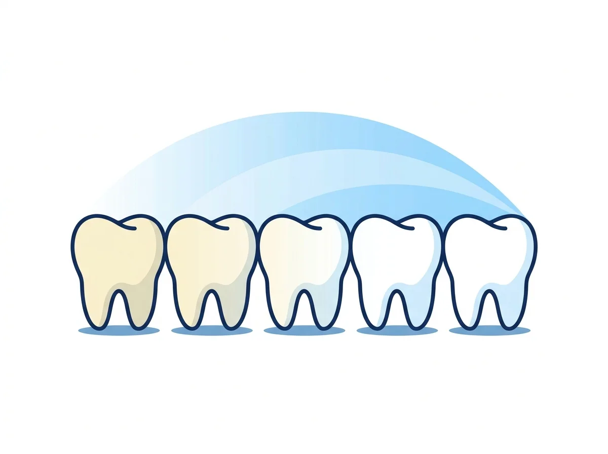Ilustração de dentes clareando de tom